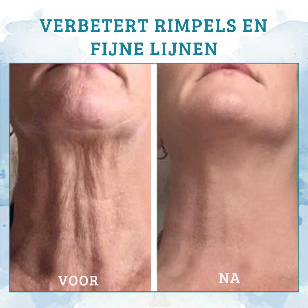 LiftPure™ - Direct Een Jongere Huid!